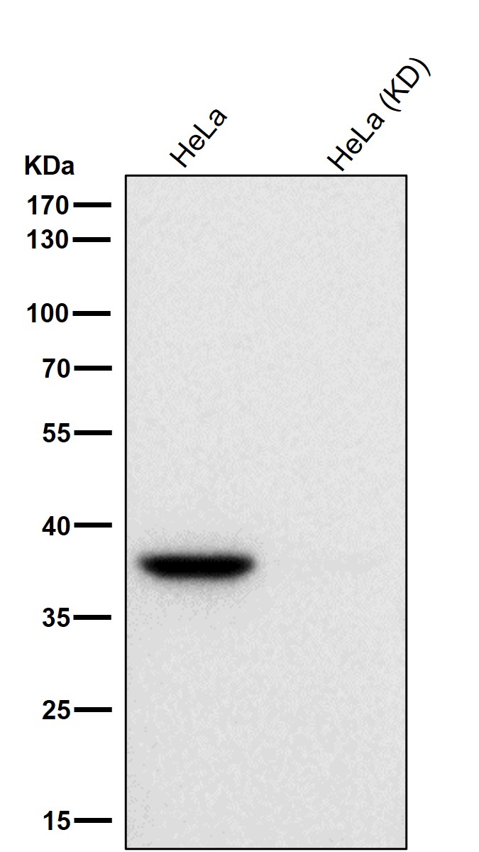 alpha Smooth muscle actin Ab