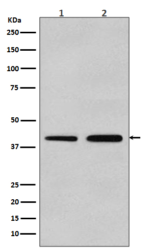 alpha Smooth muscle actin Ab