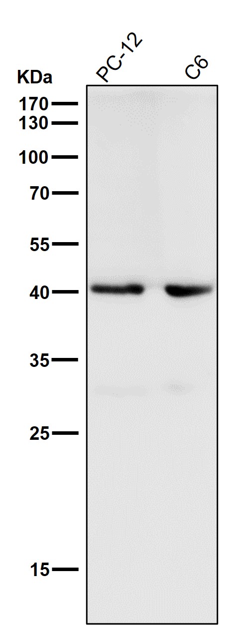 alpha Smooth muscle actin Ab