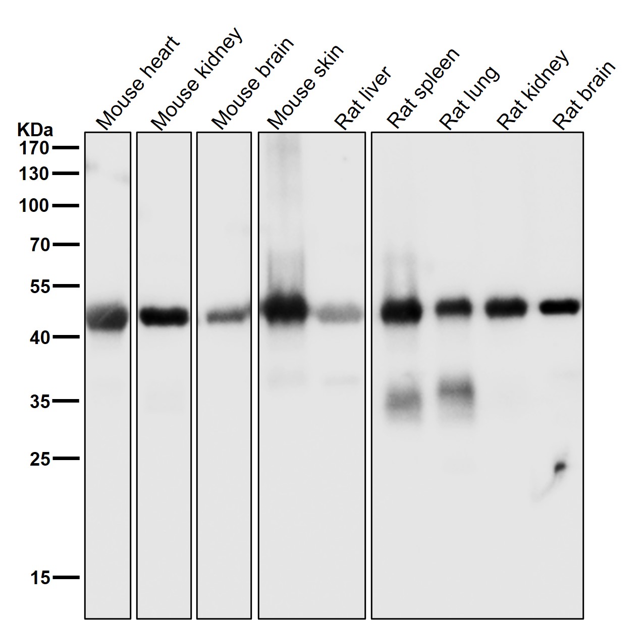 alpha Smooth muscle actin Ab