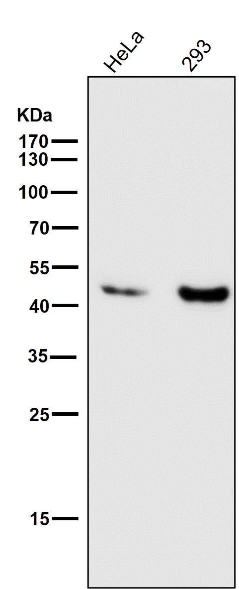 alpha Smooth muscle actin Ab