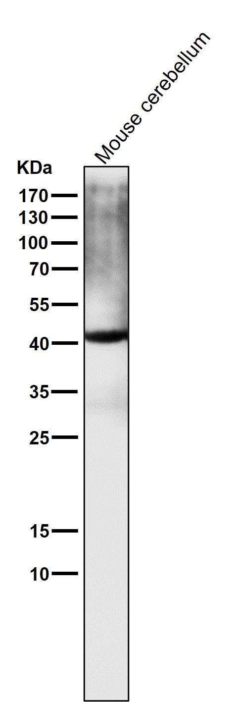 alpha Smooth muscle actin Ab