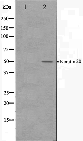 Cytokeratin 20 Ab