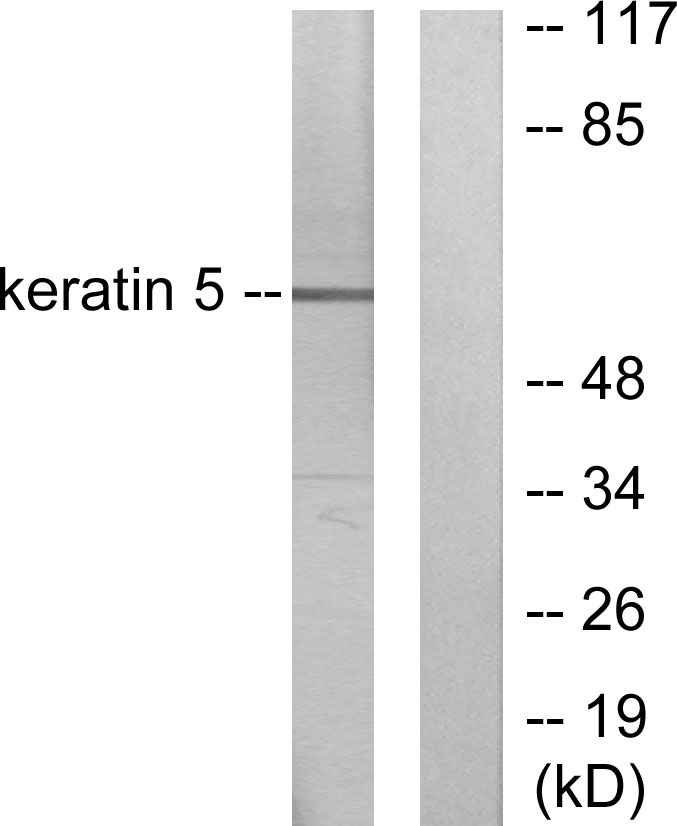 Cytokeratin 5 Ab