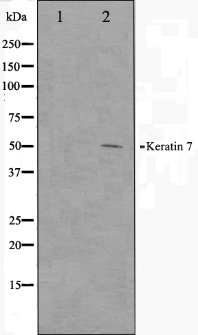 Cytokeratin 7 Ab