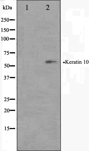 Cytokeratin 10 Ab