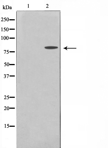 MMP15 Ab