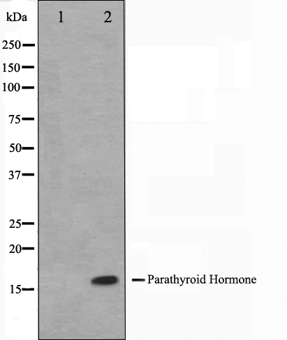 Parathyroid hormone Ab