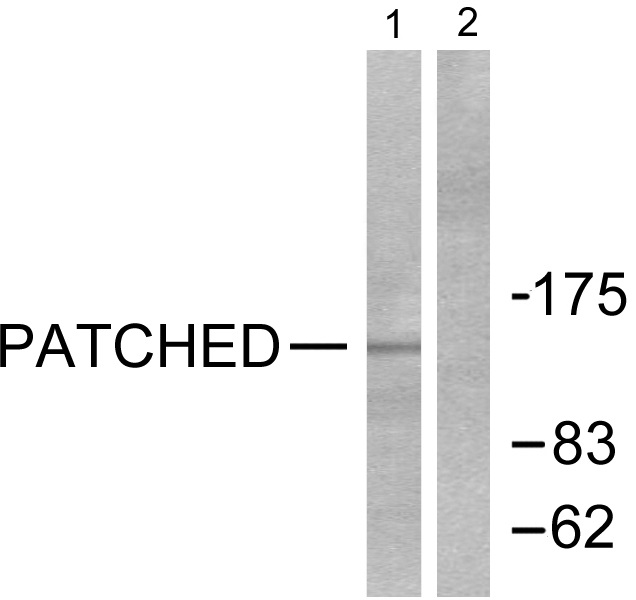 PTC Ab