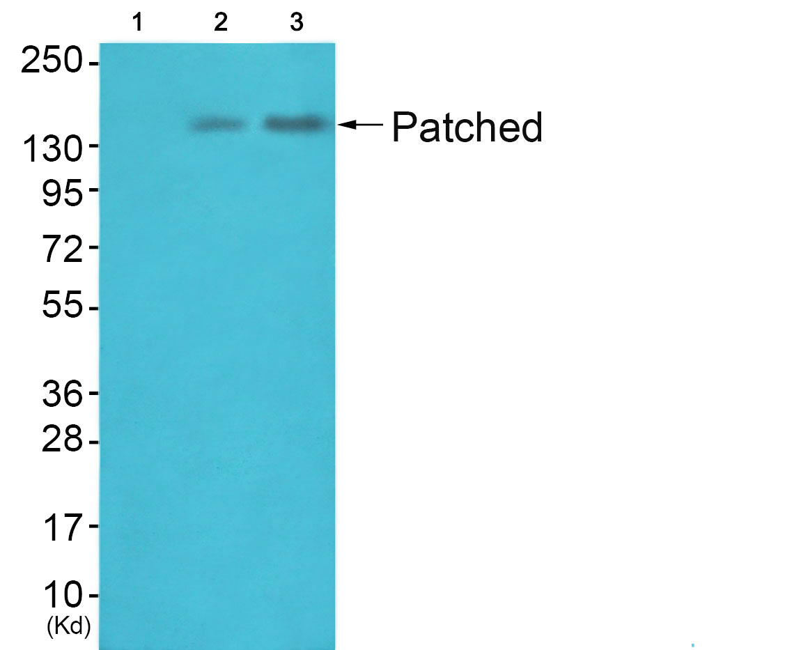 PTC Ab