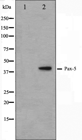 PAX5 Ab