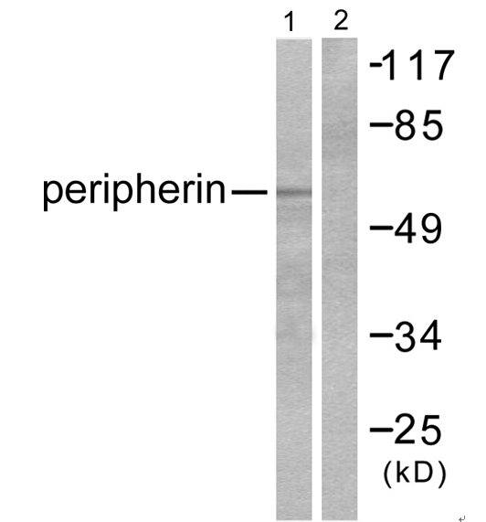 Peripherin Ab