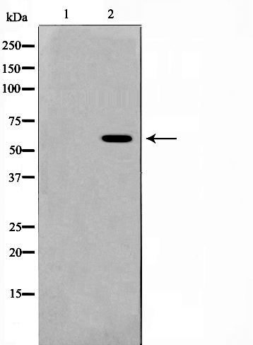 Presenilin 1 Ab