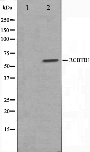 RCBTB1 Ab