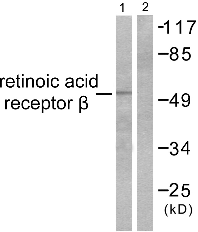 Retinoic acid receptor beta Ab