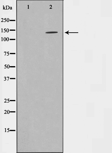 INPP5D Ab