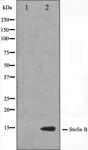 Cystatin B Ab