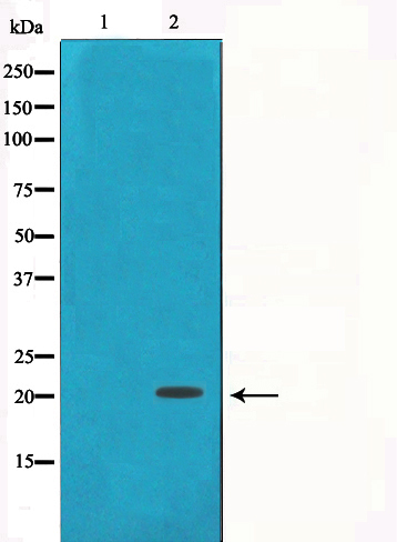 gamma Synuclein Ab