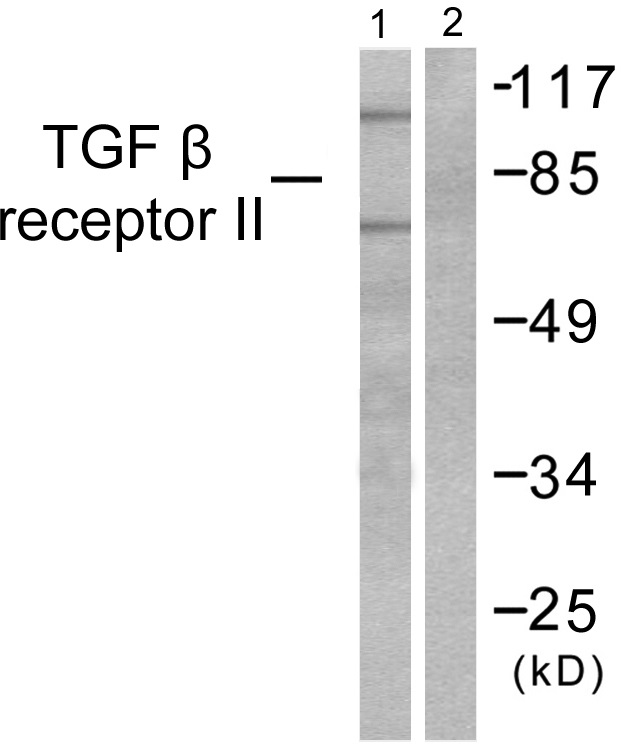 TGFR 2 Ab