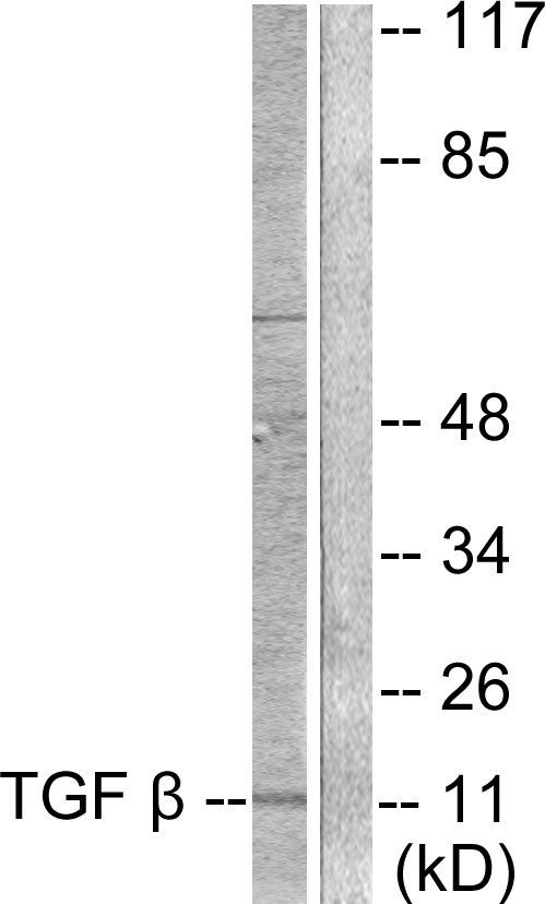 TGF beta 3 Ab