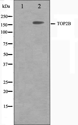 DNA topoisomerase 2 beta Ab