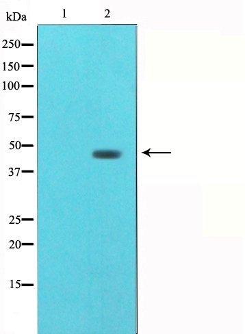 gamma 2 Tubulin Ab