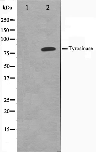 Tyrosinase Ab