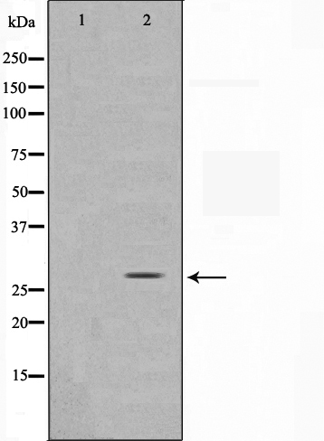 Sumo 1 Ab