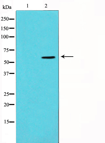 Vimentin Ab