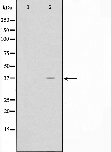 Nucleophosmin Ab