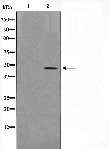 CEBP beta Ab