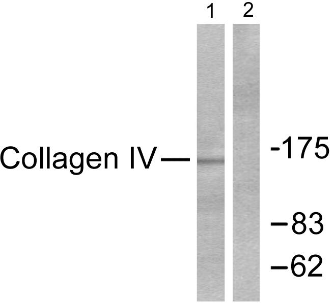 Collagen IV alpha 1 Ab