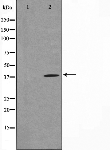 Gastrin Ab