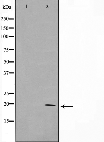 Adenylate kinase 6 Ab