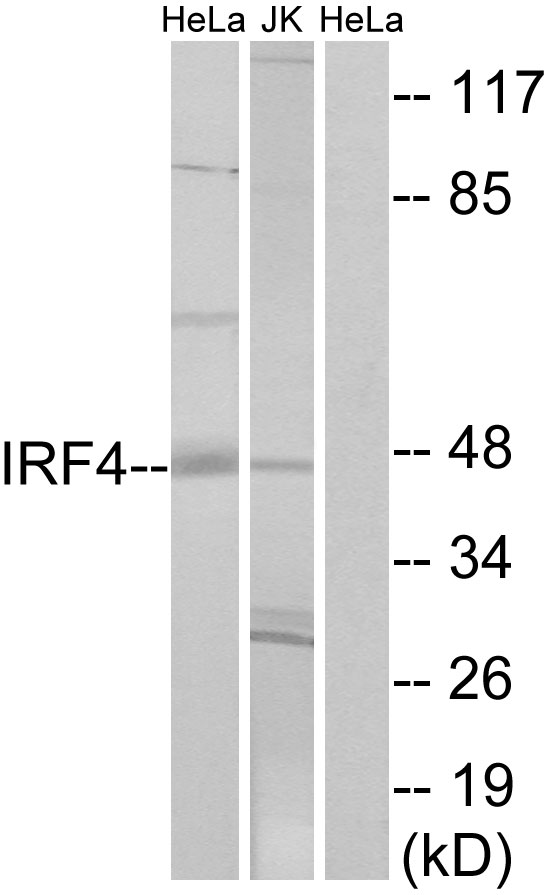 IRF4 Ab