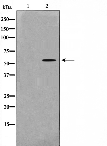 Glycerol kinase 2 Ab