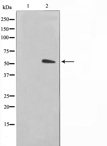 Cytokeratin 15 Ab