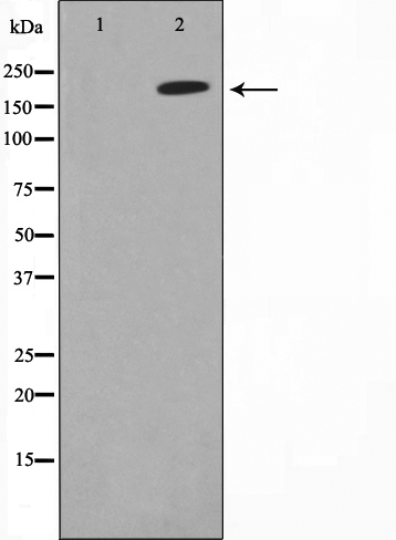 Topoisomerase 2 alpha Ab