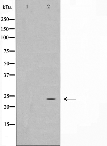 IPP 2 Ab