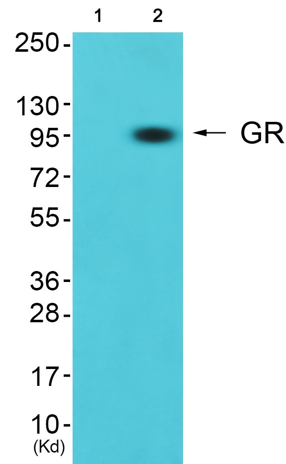 Glucocorticoid receptor Ab