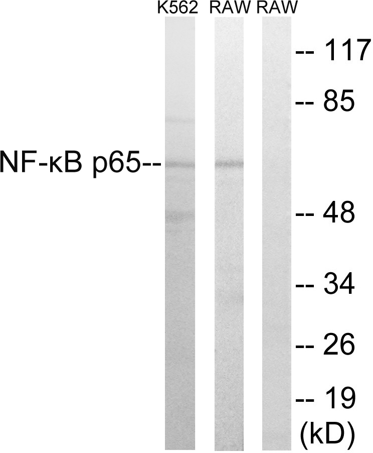 NF-kB p65 Ab