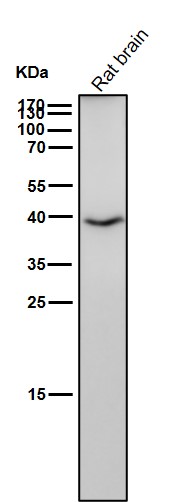 GSK 3 beta Ab