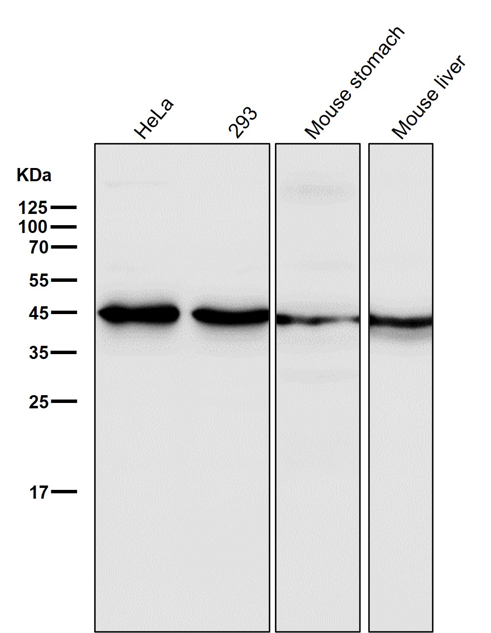 GSK 3 beta Ab