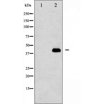 Cleaved-Caspase 8 p10 Ab