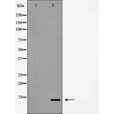 beta Synuclein Ab