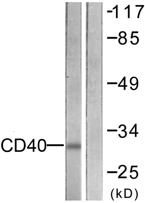 CD40 Ab