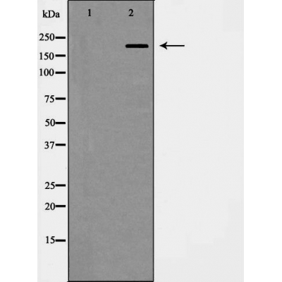 Integrin beta 4 Ab