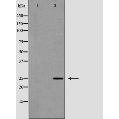 PGP9.5 Ab