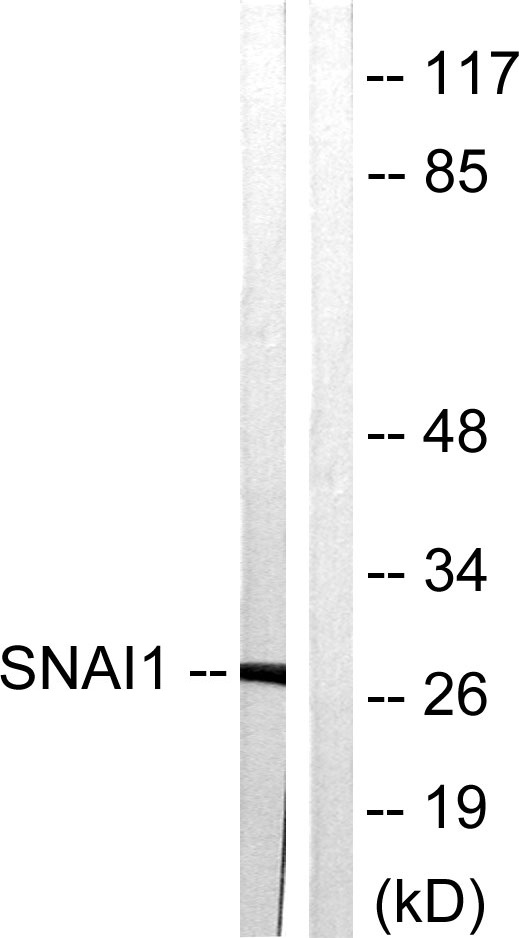 SNAI1 Ab