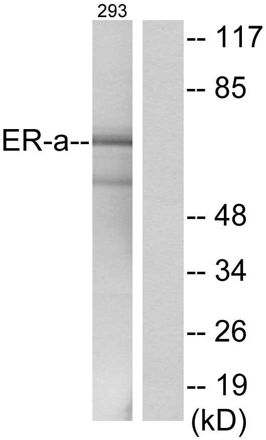 Estrogen receptor Ab